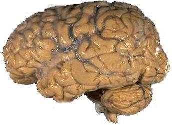 Human brain NIH